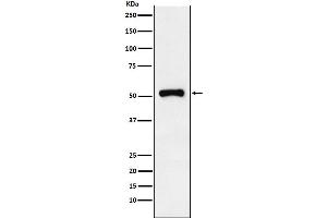 Western blot analysis of Retinoic Acid Receptor gamma expression in HeLa cell lysate.