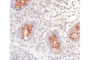 Immunohistochemistry of paraffin-embedded Human appendix using KIR3DL3 Polyclonal Antibody at dilution of 1:100 (40x lens). (KIR3DL3 anticorps)