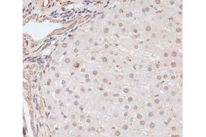 Immunohistochemistry of paraffin-embedded Rat liver using Phospho-BRCA1(S1423) Polyclonal Antibody at dilution of 1:100 (40x lens). (BRCA1 anticorps  (pSer1423))