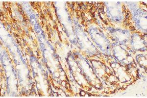Immunohistochemistry of paraffin-embedded Rat colon using CD44 Polycloanl Antibody at dilution of 1:200 (CD44 anticorps)