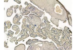 ABIN6257334 and ABIN6274315 at 1/100 staining human normal placenta tissue by IHC-P. (MVK anticorps  (Internal Region))