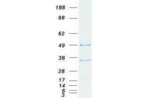 Validation with Western Blot