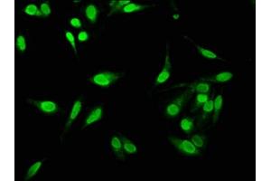 Immunofluorescence staining of Hela cells with ABIN7161811 at 1:533, counter-stained with DAPI.