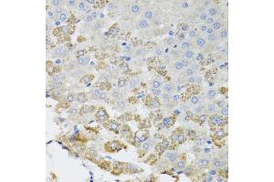 Immunohistochemistry of paraffin-embedded rat liver using TROVE2 antibody (ABIN5975457) at dilution of 1/100 (40x lens). (TROVE2 anticorps)