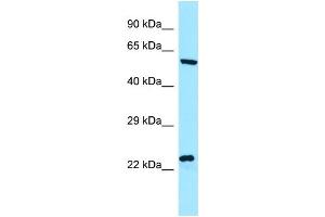 WB Suggested Anti-NCLN Antibody Titration: 1. (Nicalin anticorps  (C-Term))