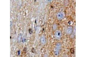 Used in DAB staining on fromalin fixed paraffin-embedded Brain tissue (GDF10 anticorps  (AA 337-477))