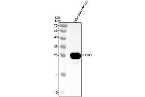 anti-Notochord Homeobox (NOTO) (AA 1-241) antibody