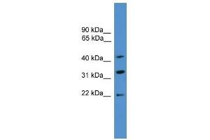 Western Blot showing ARFIP1 antibody used at a concentration of 1-2 ug/ml to detect its target protein. (ARFIP1 anticorps  (C-Term))