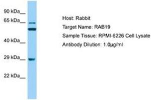 Image no. 1 for anti-RAB19, Member RAS Oncogene Family (RAB19) (AA 40-89) antibody (ABIN6749888) (RAB19 anticorps  (AA 40-89))