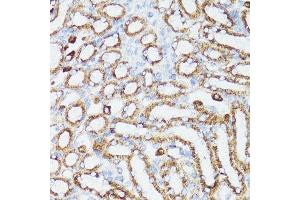 Immunohistochemistry of paraffin-embedded mouse kidney using CYCS antibody. (Cytochrome C anticorps  (AA 1-105))