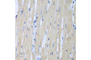 Immunohistochemistry of paraffin-embedded rat heart using CSF3R antibody at dilution of 1:100 (40x lens). (CSF3R anticorps)