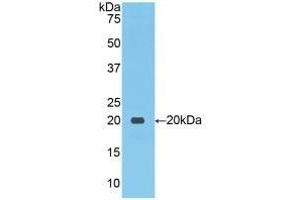 Detection of Recombinant NCCT, Human using Polyclonal Antibody to Na-Cl Cotransporter (NCCT) (SLC12A3 anticorps  (AA 867-1024))