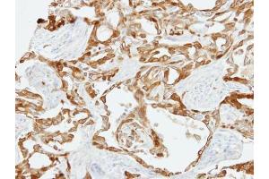 IHC-P Image Immunohistochemical analysis of paraffin-embedded H661 xenograft, using Fibulin 2, antibody at 1:500 dilution. (FBLN2 anticorps  (N-Term))