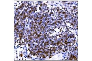 IHC analysis of PML Protein/Pml using anti-PML Protein/Pml antibody (ABIN7599678). (PML anticorps  (AA 107-857))