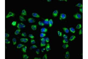 Immunofluorescence staining of Hela cells with ABIN7175196 at 1:133, counter-stained with DAPI.