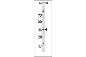 Western blot analysis of Islet-2 / ISL2 Antibody (N-term) in A2058 cell line lysates (35ug/lane). (ISL2 anticorps  (N-Term))