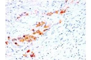 Formalin-fixed, paraffin-embedded human Bladder stained with CD44v4 Mouse Recombinant Monoclonal Antibody (rCD44v4/1219). (Recombinant CD44 anticorps)