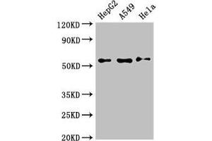 Western Blot Positive WB detected in: HepG2 whole cell lysate, A549 whole cell lysate, Hela whole cell lysate All lanes: NECTIN2 antibody at 3 μg/mL Secondary Goat polyclonal to rabbit IgG at 1/50000 dilution Predicted band size: 58, 52 kDa Observed band size: 58 kDa