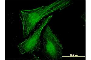 Immunofluorescence of monoclonal antibody to SLC27A2 on HeLa cell.