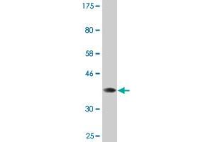 Western Blot detection against Immunogen (34.