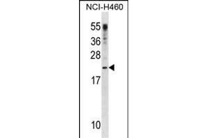 CSF3 Antibody (C-term) (ABIN1881232 and ABIN2838611) western blot analysis in NCI- cell line lysates (35 μg/lane). (G-CSF anticorps  (C-Term))