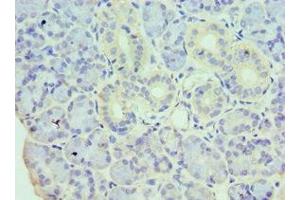 Immunohistochemistry of paraffin-embedded human pancreatic tissue using ABIN7155328 at dilution of 1:100 (HDAC8 anticorps  (AA 1-377))