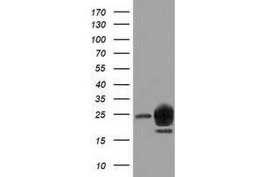 Western Blotting (WB) image for anti-Lin-7 Homolog B (LIN7B) antibody (ABIN1499157) (LIN7B anticorps)
