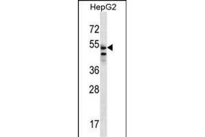 SLC29A3 Antibody (N-term) (ABIN656792 and ABIN2846011) western blot analysis in HepG2 cell line lysates (35 μg/lane). (SLC29A3 anticorps  (N-Term))