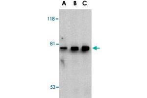 Western blot analysis of BTK in U-937 cell lysate with BTK polyclonal antibody  at (A) 0. (BTK anticorps  (N-Term))
