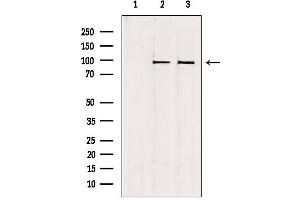 Western blot analysis of extracts from various samples, using NSUN2 antibody. (NSUN2 anticorps  (Internal Region))