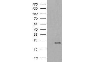 Image no. 1 for anti-HRas proto-oncogene, GTPase (HRAS) antibody (ABIN1498717) (HRAS anticorps)