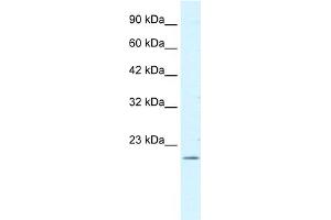 WB Suggested Antibody  Titration: 0. (FOXP2 anticorps  (N-Term))