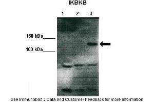 Lanes:   Lane 1: 10ug 293T lysate (empty vector) Lane 2: 10ug IKKalpha-V5 transfected 293T lysate Lane 3: 10ug IKKbeta-V5 transfected 293T  Primary Antibody Dilution:    1:1000  Secondary Antibody:   Anti-rabbit HRP  Secondary Antibody Dilution:    1:2000  Gene Name:   IKBKB  Submitted by:   Dr. (IKBKB anticorps  (Middle Region))