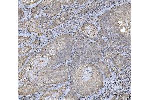 IHC analysis of HLA-DRA using anti-HLA-DRA antibody (ABIN7600950).
