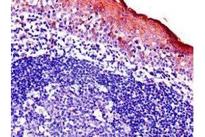 Immunohistochemistry of paraffin-embedded human tonsil tissue using ABIN7145203 at dilution of 1:100