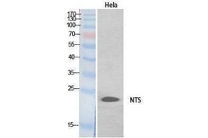 Western Blotting (WB) image for anti-Neurotensin (NTS) (Internal Region) antibody (ABIN3178551) (Neurotensin anticorps  (Internal Region))