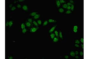 Immunofluorescent analysis of HepG2 cells using ABIN7150116 at dilution of 1:100 and Alexa Fluor 488-congugated AffiniPure Goat Anti-Rabbit IgG(H+L) (DNMT3B anticorps  (AA 1-100))