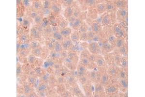 Used in DAB staining on fromalin fixed paraffin- embedded liver tissue