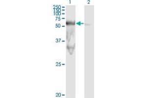 Western Blot analysis of PEPD expression in transfected 293T cell line by PEPD monoclonal antibody (M01), clone 1D5-H3.