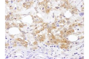 Immunohistochemistry (IHC) image for anti-Mitogen-Activated Protein Kinase Kinase 7 (MAP2K7) (AA 1-50) antibody (ABIN7455014)