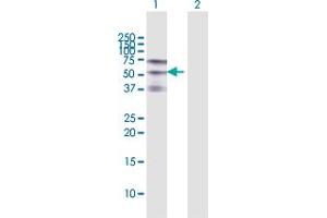Western Blot analysis of ZSCAN20 expression in transfected 293T cell line by ZSCAN20 MaxPab polyclonal antibody. (ZSCAN20 anticorps  (AA 1-433))