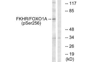 Western Blotting (WB) image for anti-Forkhead Box O1 (FOXO1) (pSer256) antibody (ABIN1847474) (FOXO1 anticorps  (pSer256))