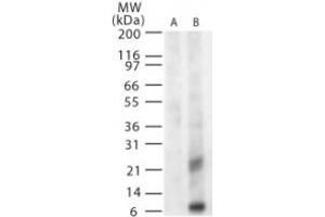 WNVM Western Blot. (WNV M anticorps)