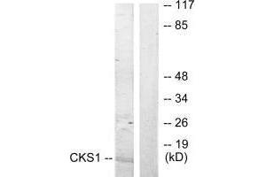 Western blot analysis of extracts from Jurkat cells, treated with serum (20 % , 15 mins), using CKS1 antibody. (CKS1 anticorps  (N-Term))