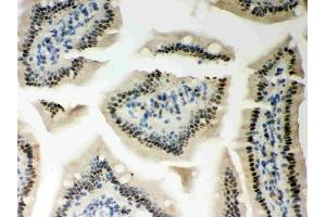 Anti-PKC epsilon Picoband antibody, (ABIN3043908), IHC(P)IHC(P): Mouse Intestine Tissue (PKC epsilon anticorps  (AA 53-236))
