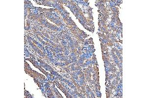 IHC analysis of SLC40A1 using anti-SLC40A1 antibody (ABIN7599484).