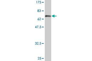 Western Blot detection against Immunogen (74. (Fatty Acid Synthase anticorps  (AA 1-439))