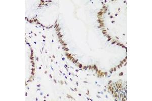 Immunohistochemistry of paraffin-embedded human gastric using PCNA antibody. (PCNA anticorps  (AA 1-261))
