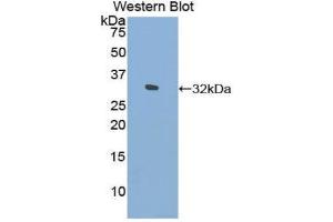 Western Blotting (WB) image for anti-Filamin C, gamma (FLNC) (AA 17-259) antibody (ABIN1858903) (FLNC anticorps  (AA 17-259))
