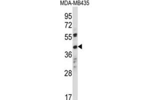 Western Blotting (WB) image for anti-Olfactory Receptor, Family 8, Subfamily K, Member 1 (OR8K1) antibody (ABIN2997661) (OR8K1 anticorps)